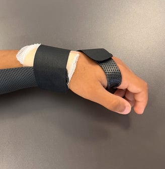 órtese para fratura de rádio distal