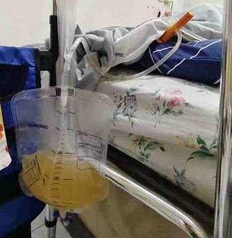urine bag