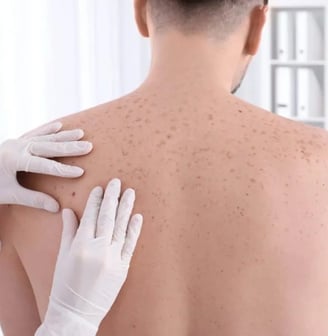 Dermato em Paulinia