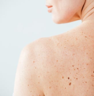 Dermatologia Paulinia