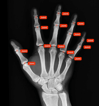 Healthcare Data Annotation with Quantify Data Solutions