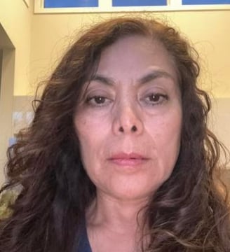 Face Yoga Result - After