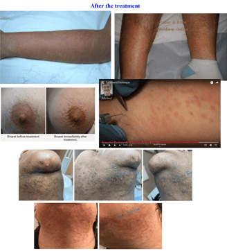 after-electrolysis-treatment