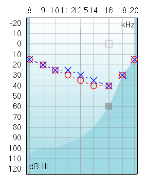 A high frequency audiogram