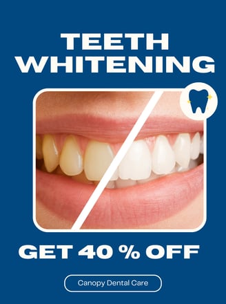 teeth whitening in baner