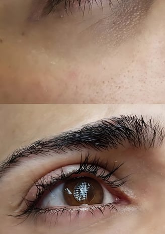 Micropigmentación de Ojeras