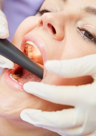 Root canal therapy delivering expert oral care to treat infected teeth, relieve pain, and save natur