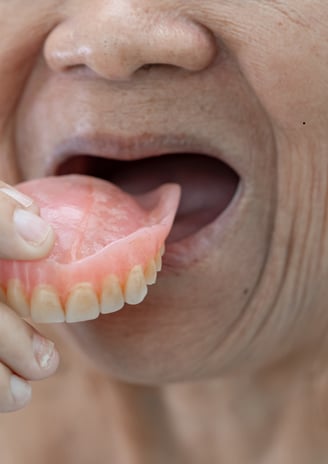Full and partial dentures offering customized dental care to replace missing teeth and restore oral