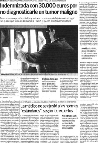 cáncer de mama tumor maligno en el pecho