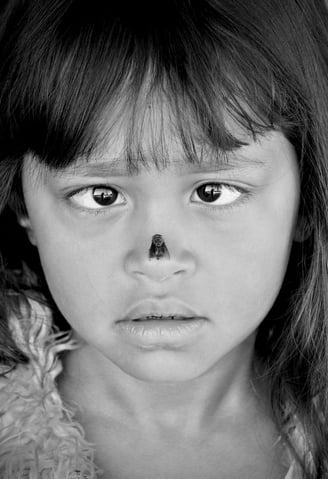 Peter Pickering's lens captures a rare moment as a fly lands on a child's nose sending her crosseyed