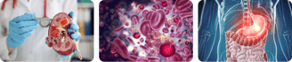 Kidney, blood and stomach cancer treatments by Dr.Runu Sharma, expert Oncologist at Uttarakhand