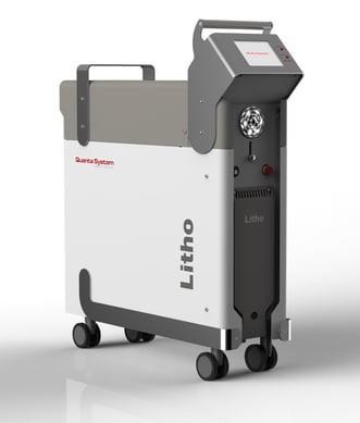 Laser for kidney stone