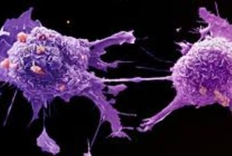Curable Cancers And Effect Of Voluntary Fasting (4)