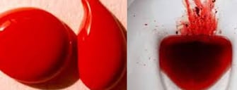 When to worry about blood in your stool