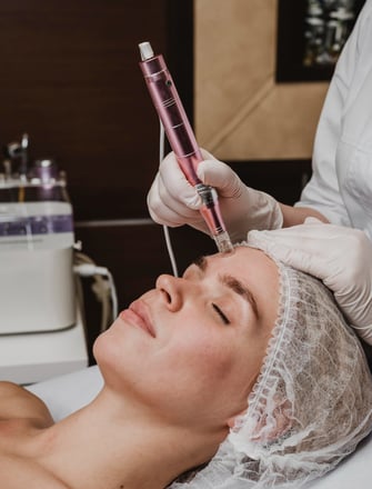 a woman getting a facial lift in a beauty salon microneedling