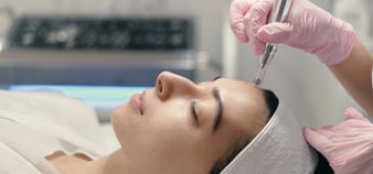 a woman is getting her face microneedled