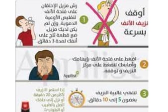 اوقف النزفكيف تدير نزيف الانف :علاج نزيف الانف الخلفي بالعسل والمضمضة