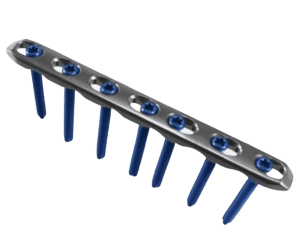 Placa Recta para Radio y Cúbito