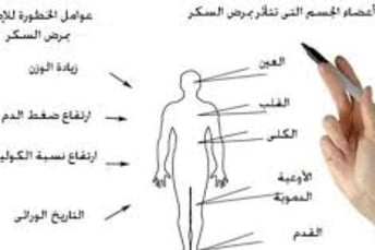 كيف يحدث السكرى