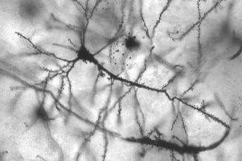 Neurons featuring dendritic spines