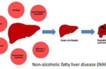 cirrhosis, esophageal varices and hepatoma