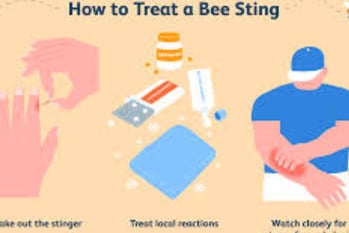 Bee Therapy  the Benefits and Uses of Bee Venom (4)