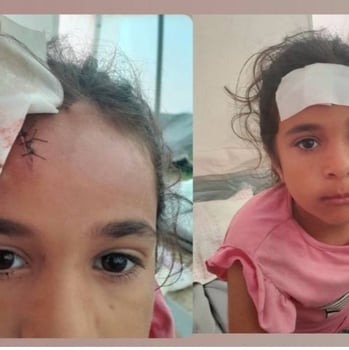 a woman with a bandage on her forehead and a bandage on her forehead
