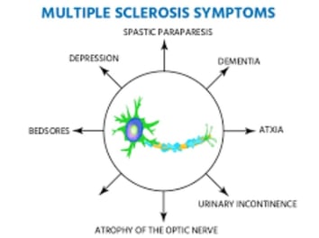 causes & symptoms multiple sclerosis