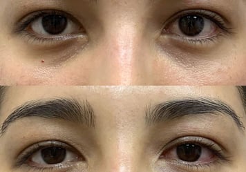 Orbit & Oculoplasty