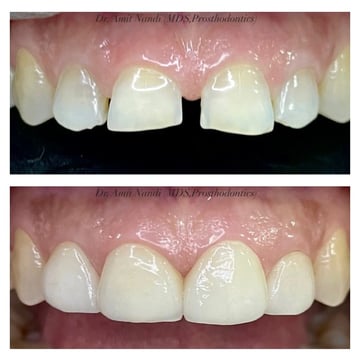 best smile designed dental kolkata
