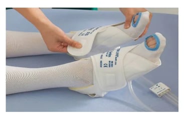 DVT Disposable Foot Cuff Starvent Health Care