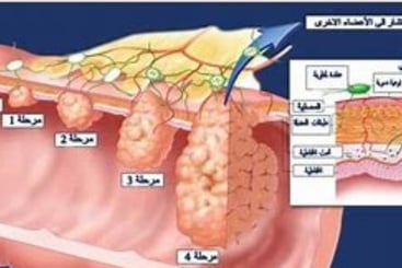 فيمكن أن يكون طفيفًا أو موجعًا أو حادًّا أو حارقًا. ويمكن أن يكون ثابتًا أو متقطعًا أو معتدلًا أو مت