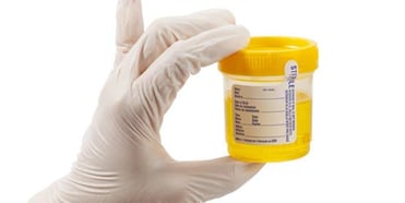 campione di orina da esaminare