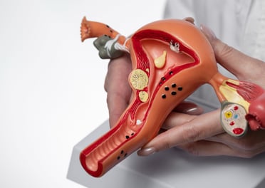Uterine Cancer