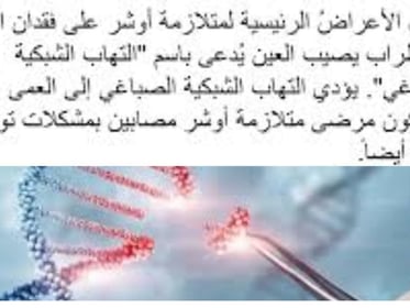 متلازمة آ,شر