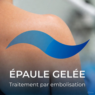 épaule gelée logo