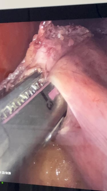 Cirurgia Bariátrica Dr Marcelo Machado