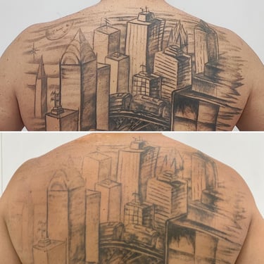 eliminación de tatuajes barcelona 