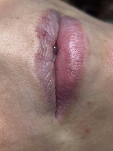 micropigmentacion-labios-efecto-acuarela-madrid-lips