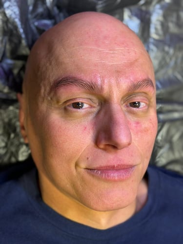 micropigmentacion-cejas-pelo-a-pelo-alopecia-masculina-madrid-marta-hernanz