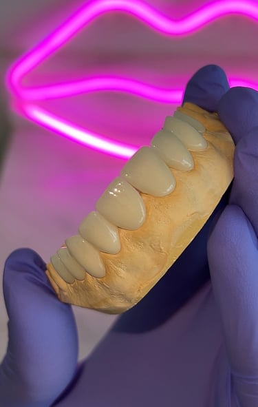 Traitement Hollywood Smile chez dentiste expert Mohammedia