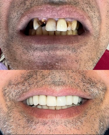 dentiste Mohammedia experte en transformation du sourire