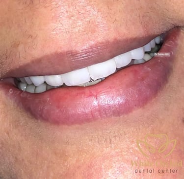 Dentiste spécialiste en transformation du sourire Mohammedia