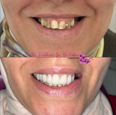 Clinique dentaire Mohammedia experte en transformation du sourire