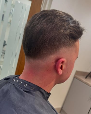 After hybrid hair loss system Hull hairlabuk