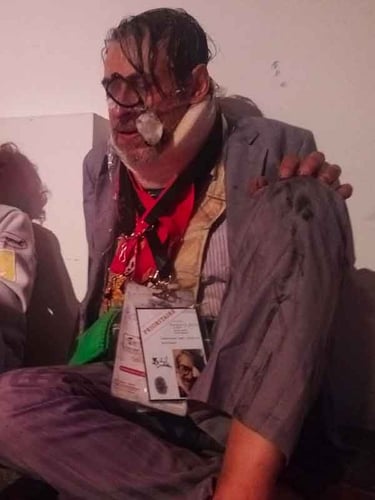 Michel Durian assis comme un sdf, ses lunettes cassées pendant en travers de son visage | David Noir | Photo Marie Verge