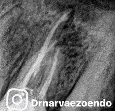 Endodoncia Quito, Dr. Juan Miguel narváez