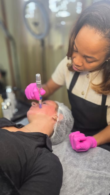 client receving microneedling treatment