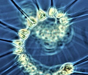 Microscopic view of a circular colony of green algae with radiating spines under blue light.