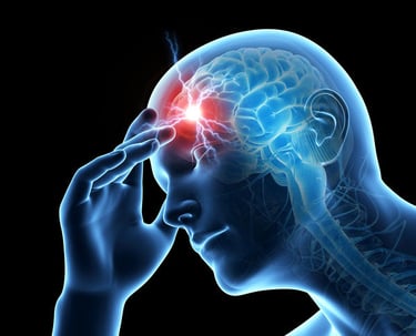 illustraion of a human head shoing the area of pain for a migrane headache